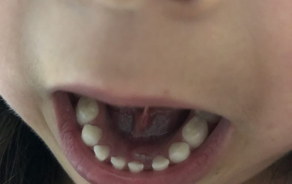 dentinho